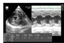 Cardiopathie du chat échographie du coeur