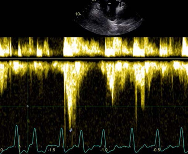 Cardiologie: prestation Doppler