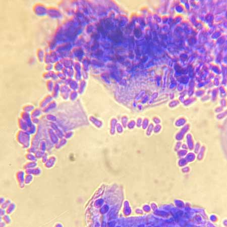 Dermatologie – Otoscopie