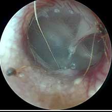 Dermatologie – Otoscopie