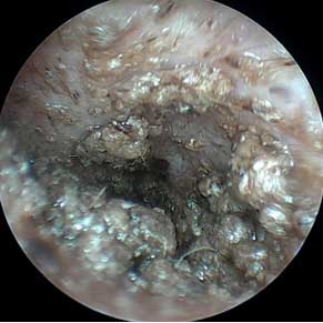Dermatologie – Otoscopie