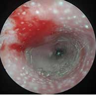 Dermatologie – Otoscopie