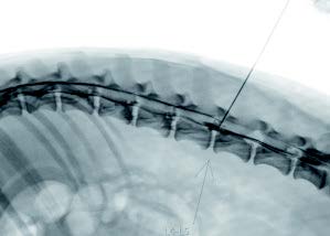 Neurochirurgie